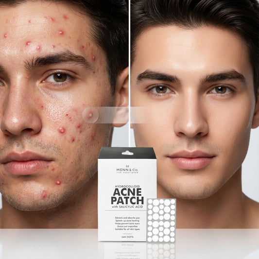 Before and after comparison of a man's face with acne using Menn & Co. hydrocolloid acne patches.
