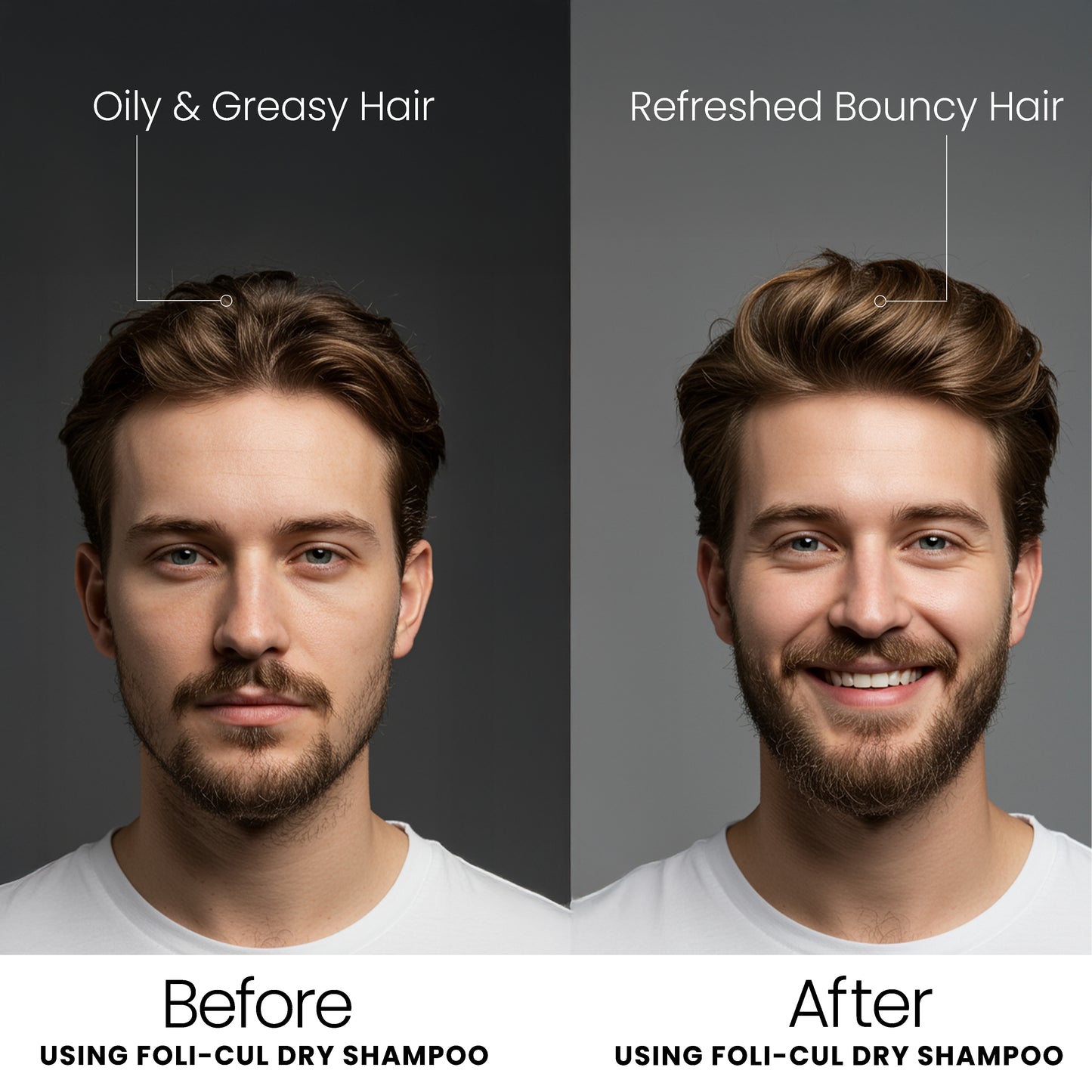 Foli-Cul Natural Dry Shampoo – Instant Oil Control, Volume Boost & Fresh Hair (Benzene-Free)