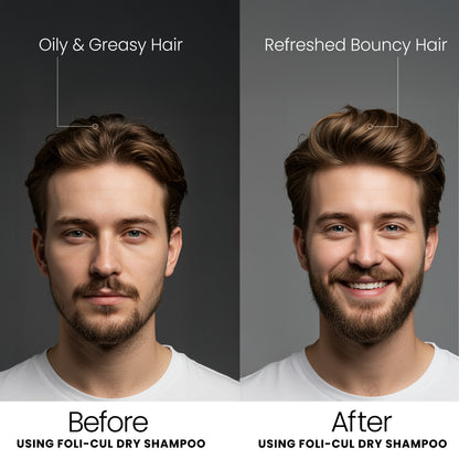 Foli-Cul Natural Dry Shampoo – Instant Oil Control, Volume Boost & Fresh Hair (Benzene-Free)