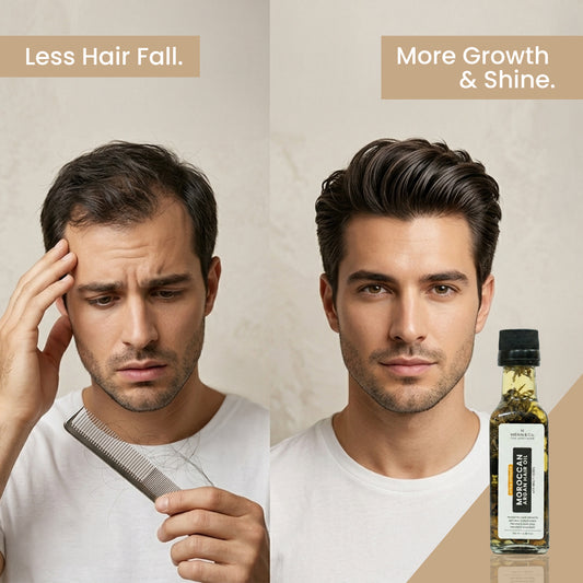 Before and after comparison of a man with hair fall and growth, alongside a bottle of hair care product.