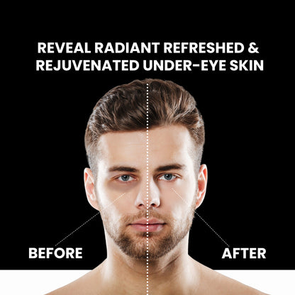 EYEZE Under Eye Roll-On Serum for Men | Reduces Dark Circles & Puffiness