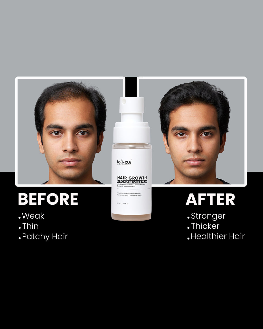 Foli-Cul Hair Growth & Bond Repair Spray for Men | Stronger, Thicker Hair